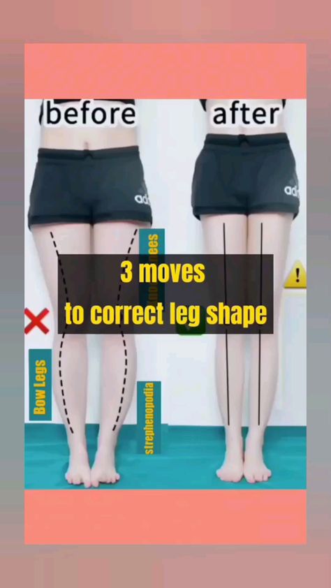 "Sculpt the perfect leg shape with these targeted exercises! 🦵 Discover the best workouts to enhance and tone your legs for a flawless look. Elevate your fitness routine and unlock confidence. #LegWorkouts #FitnessTips #PerfectLegs #HealthyLiving" Perfect Leg Shape, Knock Knees Exercises, Bow Legged Correction, Slim Legs Workout, Bigger Buttocks Workout Exercises, Workout Videos For Women, Knock Knees, Knee Strengthening Exercises, Leg Workout Routine