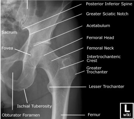 Ortho Blog - CMC COMPENDIUM Radiology Anatomy, Radiographic Anatomy, Radiography Student, Anatomi Dan Fisiologi, Radiology Schools, Medical Radiography, Bone Tissue, Radiologic Technology, Radiologic Technologist