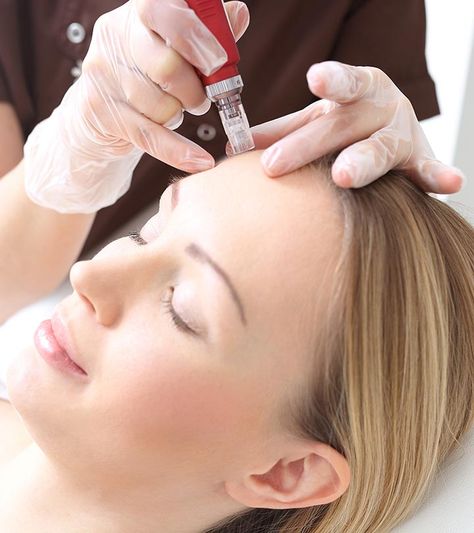 Microneedling After Care, Mesotherapy Face, Skinpen Microneedling, Benefits Of Microneedling, Microneedling At Home, Castro Oil, After Microneedling, Aesthetic Procedures, Microneedling Pen