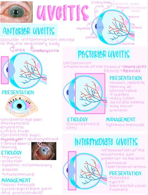 Optometry School Notes, Opthamology Notes, Optometry Notes, Ophthalmology Notes, Ocular Anatomy, Medical Study Notes, Opthalmic Technician, Optician Training, Optometry Education