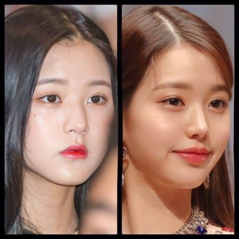 Wonyoung Plastic Surgery Before And After, Wonyoung Nose, Korean Nose Job, Kpop Plastic Surgery, Jaw Reduction Surgery, Nose Scrunch, V Line Surgery, Lip Surgery, Plastic Surgery Fail