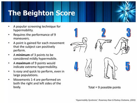 Hypermobile Ehlers Danlos Syndrome, Autonomic Dysreflexia, Elhers Danlos Syndrome, Ehlers Danlos Syndrome Hypermobility, University Teaching, Mast Cell Activation Syndrome, Law School Life, Spoonie Life, Ehlers Danlos