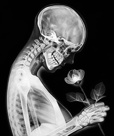 Xray Art, Black And White Photo Wall, Black And White Picture Wall, Skeleton Art, A Skeleton, Gray Aesthetic, Photo Wall Collage, Black And White Aesthetic, Black Aesthetic Wallpaper