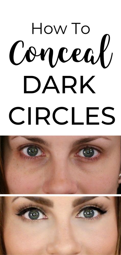 Cover Up Dark Circles Under Eyes, Conceal Dark Circles, Dark Under Eye Circles, Dark Circles Makeup, My Makeup Routine, Dark Circles Around Eyes, Angela Lanter, Under Eye Makeup, Hide Dark Circles