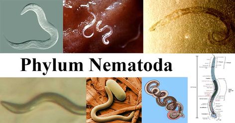 Nematoda Definition Nematodes (Gr., nema thread+ eidos, form) are commonly referred to as non-segmented roundworm, threadworm or pinworm, as distinct from flatworm and higher segmented annelids. Image Source: Wikipedia Phylum Nematoda Characteristics They are widely distributed, aquatic or terrestrial, parasitic ... Read more The post Phylum Nematoda- characteristics, classification, examples appeared first on Microbe Notes. Microbiology Notes, Excretory System, Organ System, Cell Membrane, Respiratory System, Microbiology, All About Plants, Colorful Makeup, Biology