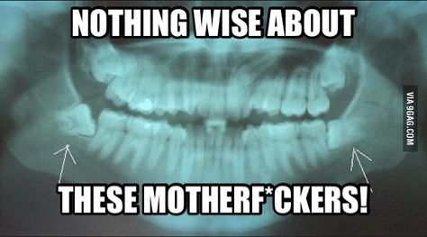 Wisdom Teeth Meme, Wisdom Teeth Quotes, Impacted Wisdom Teeth, Zoom Teeth Whitening, Dental Quotes, Teeth Whitening Remedies, Wisdom Teeth Removal, Dental Emergency, Emergency Dentist