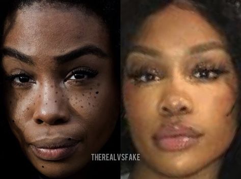 Sza Singer Before And After Surgery, Sza Singer Nose Contour, Reality Vs Instagram, Dream Nose, Ethnic Rhinoplasty, Lip Surgery, Sza Singer, Filters Instagram, Nose Contour