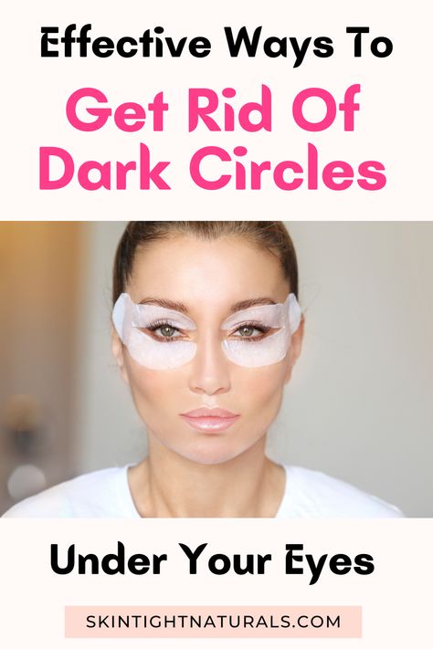 Have you been struggling with getting rid of dark circles under your eyes? Have you tried tons of DIY remedies and nothing seems to work? We understand! Dark circles under the eyes look better on a raccoon than on you! It’s time to stop looking like a masked bandit and say good-bye to those annoying dark circles. Find out the causes of dark circles and how to get rid of them in 5 easy steps. #getridofdarkcircles #eyecare #darkcircles #darkcircleremedies #darkcirclescream #skintightnaturals Causes Of Dark Circles, Getting Rid Of Raccoons, Under Eye Dark Circles, Eye Dark Circles, Dark Circle Remedies, Dark Eye Circles, Under Eye Puffiness, Remove Dark Circles, Under Eyes