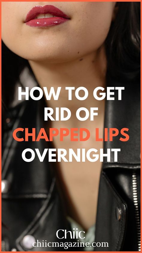 Home Remedies to Get Rid Of Chapped Lips Overnight Remedies For Chapped Lips, Dry Lips Remedy, Chapped Lips Remedy, Natural Remedies For Migraines, Beauty Culture, Lip Care Routine, Dry Skin Remedies, Natural Sleep Remedies, A Rat