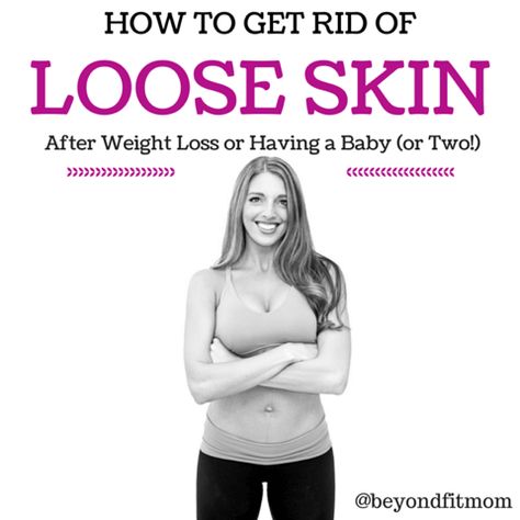 Are you struggling with loose skin after weight loss? Get my five tips on how to get rid of loose skin here! Get Rid Of Loose Skin, After Baby Workout, Skin Tightening Stomach, Tighten Loose Skin, Baby Workout, Excess Skin, Loose Skin, After Baby, Life Tips