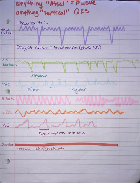 Med Surg Nursing Cardiovascular, Cardiac Arrhythmias Nursing, Med Surg Cardiovascular, Med Surg 2 Nursing, Nursing School Med Surg, Med Surg Cardiac, Cardiac Assessment Nursing, Peds Cardiac Nursing, Cardiac Rhythms Cheat Sheets