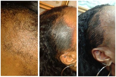 Lost Your Edges? - Would You Ever Consider An Edge Tattoo? - https://blackhairinformation.com/general-articles/opinion/lost-edges-ever-consider-edge-tattoo/ Tattoo Edges Hair, Hair Line Tattoo, Edge Tattoo, Blow My Mind, Alopecia Hairstyles, Los Angeles Tattoo, Edges Hair, Hair Line, Line Tattoos