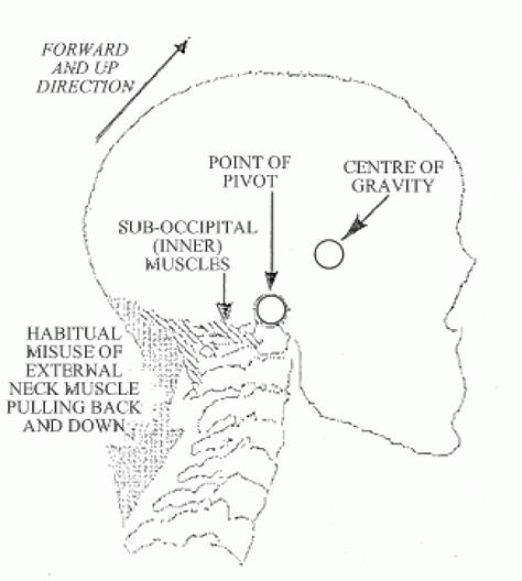 The Role of the Alexander Technique in Back Care. #Backpain Alexander Method, Alexander Technique Exercises, Singing Exercises, Alexander Technique, Forward Head Posture, Craniosacral Therapy, Tight Hip Flexors, Back Care, Psoas Muscle