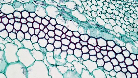 Difference Between Collenchyma and Chlorenchyma Check more at https://in4arts.com/difference-between-collenchyma-and-chlorenchyma-2.html Pumpkin Squash, Cell Structure, Textile Projects, Two Rings, Cross Section, Small Leaf, Surface Design