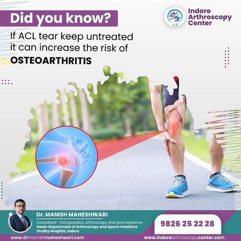 #acltear #aclrecovery #kneeinjury #osteoarthritis #orthopaedic  #indorearthroscopycenter Arthroscopic Knee Surgery, Acl Reconstruction Surgery, Rotator Cuff Surgery, Shoulder Dislocation, Acl Tear, Knee Replacement Surgery, Shoulder Surgery, Frozen Shoulder, Healthcare Marketing