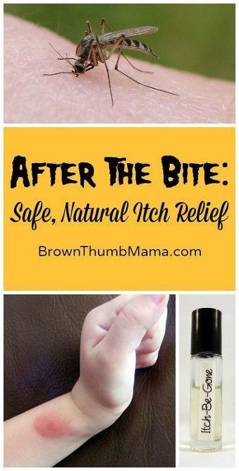 natural bug bite relief, animals, pets animals Natural Bug Bite Relief, Natural Itch Relief, Bug Bite Relief, Bite Relief, Skincare Recipes, Bug Bite, Itch Relief, Anti Itch, Natural Healing Remedies