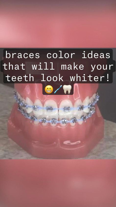 #WhoBasicPackageOfOralCare Red Rubber Bands Braces, What To Do When Getting Braces, The Best Braces Colors To Get, Braces Colours That Make Your Teeth Look Whiter, Winter Braces Colors Ideas, How To Put Wax On Braces, Clear Brackets With Colored Bands, Braces Colors To Avoid, Best Colors To Get For Braces