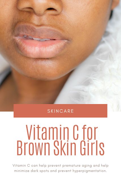 Vitamin C for Brown Skin Girls | Sisterlocked Skincare Brown Skin, Skincare For Brown Skin, Vitamin C Oil For Skin, Vitamin C Oil For Face Benefits, Skin Care For Brown Skin, Clear Brown Skin, Vitamin C For Face, Antioxidant Food, Antioxidants Benefits Skin