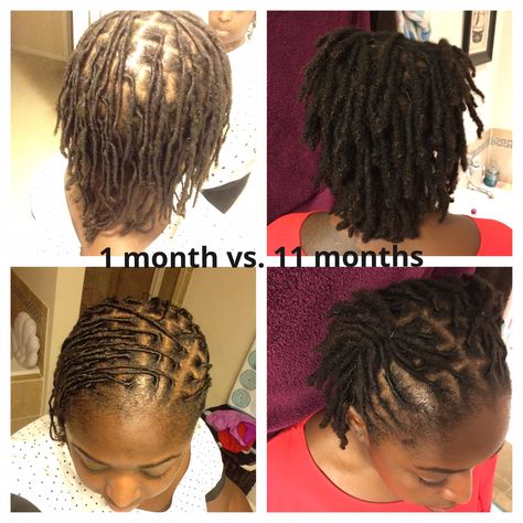 1 month vs. 11 months I started with very fine hair and my tresses have thickened up thanks to the loc process Locs Fine Hair, Starter Locs On Fine Hair, Fine Hair Locs, Loc Starter, Locs On Fine Hair, Loc Process, Locs Starting, Dreadlock Hairstyles For Women, Locs Starter