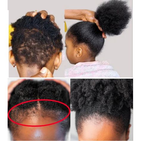 Natural Hair Growth Chart, Hair Growth Grease, Hair Growth Oil Recipe, Hair Grease, Premature Grey Hair, Rosemary Hair Growth, Growth Challenge, Herbal Hair Growth, Mary Images