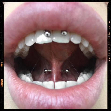 Tongue Frenulum Piercing and Smiley Piercing Idea Tounge Web Piercings, Cool Tounge Piercing, Tongue Web Piercing Aesthetic, Different Tounge Piercing, Piercing Ideas Tongue, Frenulum Tongue Piercing, Under Tounge Piercing, Under Tongue Piercing, Different Tongue Piercings