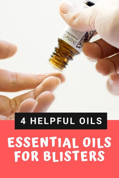 Learn how to naturally treat blisters with this essential oil remedy. Treat blisters on your feet, toes, hands, and lips #blisters #essentialoils #doterra #youngliving #naturalremedy Essential Oils For Blisters, How To Treat Blisters, Blister Remedies, Blister On Lip, How To Heal Blisters, Blood Blister, Diy Essential Oil Recipes, Essential Oil Remedy, Oil Remedies