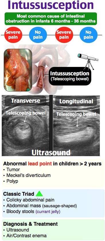 Radiology Nurse, Diagnostic Medical Sonography Student, Ultrasound School, Medical Radiography, Sonography Student, Ultrasound Sonography, Nurse Tips, Radiology Student, Medical Ultrasound