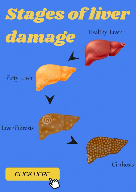 Liver Fibrosis, Quadrants Of The Abdomen, Liver Cleanse Juice, Healthy Liver Diet, Heal Liver, Lung Detox, Liver Damage, Fruit Recipes Healthy, Diy Coconut Oil