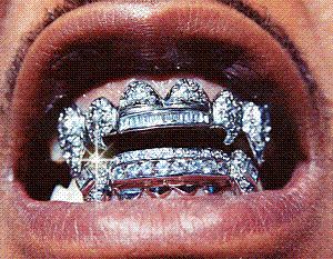 kanyerocky:   Instagram Gangsta Grillz, Grillz Teeth, Diamond Grillz, Diamond Teeth, Gold Grillz, Grills Teeth, Tooth Gem, Teeth Jewelry, Gold Teeth