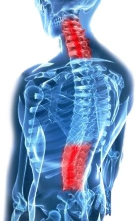 Degenerative Disc Disease - Disc Degeneration & Pain Thoracic Spine Mobility, Spinal Degeneration, Degenerative Disease, Spine Health, Joints Pain Relief, Neck Pain, Back Pain, The Back, Disease