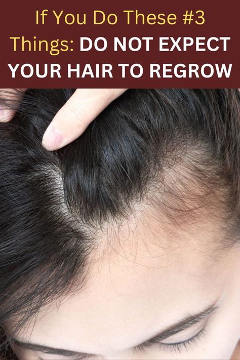 It is possible to regrow your lost hair if you follow these steps. Hair Nutrition, Thicker Fuller Hair, Lost Hair, Fuller Hair, Amino Acids, Vitamins, At Home, Herbs, Nutrition