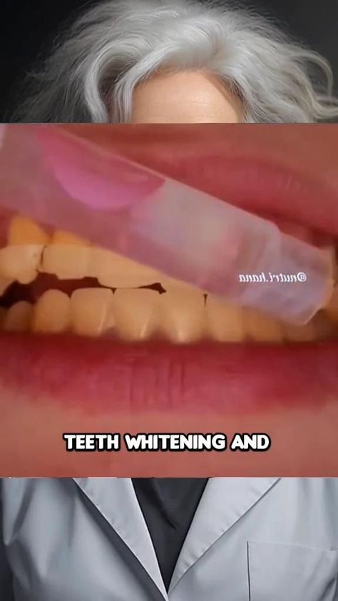 #Teeth_Care_Routine #Beginner_Skin_Care_Routine #Face_Skin_Care_Routine #Teeth_Whitening_Diy Teeth Whitening At Home, Beginner Skin Care Routine, Face Skin Care Routine, Teeth Whitening Diy, Diy Skin Care Routine, Natural Face Skin Care, Good Skin Tips, Basic Skin Care Routine, Perfect Skin Care Routine