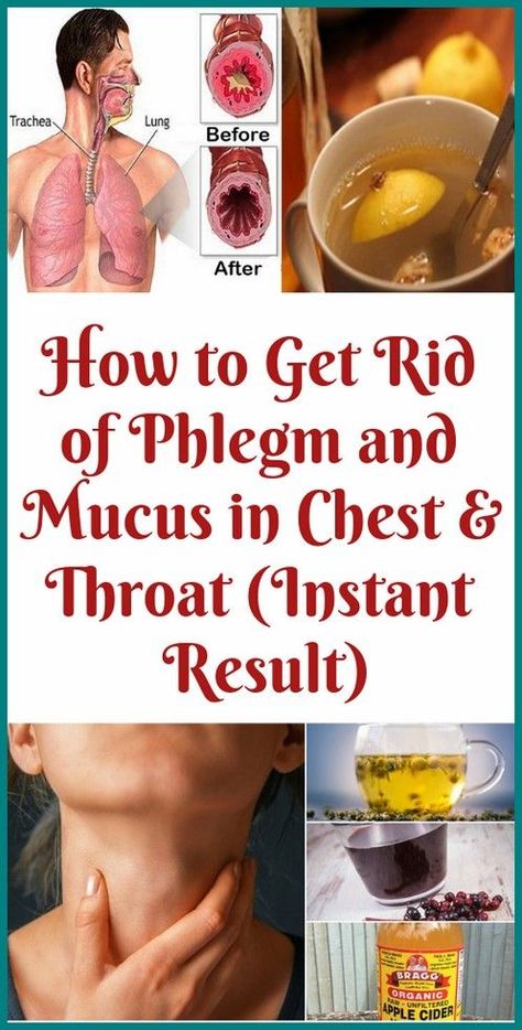 How To Get Rid Of Phlegm And Mucus In Chest & Throat (Instant Result) Phlegm In Throat, Mucus In Chest, Mucus In Throat, Getting Rid Of Mucus, Getting Rid Of Phlegm, Home Remedies For Bronchitis, Natural Face Care, Home Medicine, Organic Apple Cider