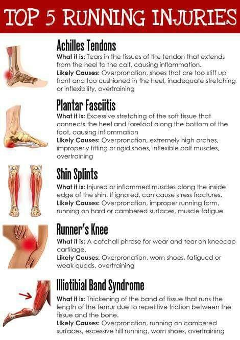 Runner injuries Workouts For Runners, Runner Problems, Runners Knee, Cross Training Workouts, Half Marathon Training Plan, Running Injuries, Sports Massage, Shin Splints, Running For Beginners