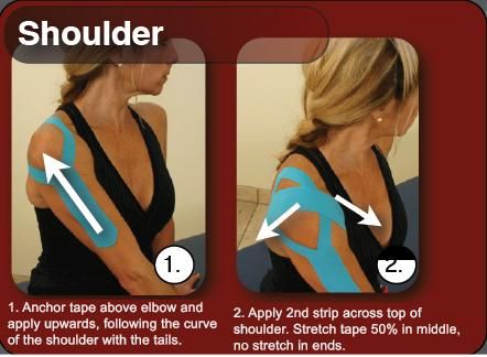 Worth a try Shoulder Kinesio Taping, Kinesio Taping Shoulder, K Tape, Rotator Cuff Injury, Posture Brace, Kt Tape, Kinesio Taping, Shoulder Surgery, Sports Tape