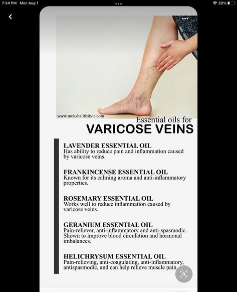 Varicose Veins Essential Oils, Varicose Vein Remedy, Essential Oils For Pain, Essential Oil Diffuser Blends Recipes, Essential Oil Remedy, Essential Oils Herbs, Essential Oils Health, Essential Oil Blends Recipes, Essential Oils For Skin