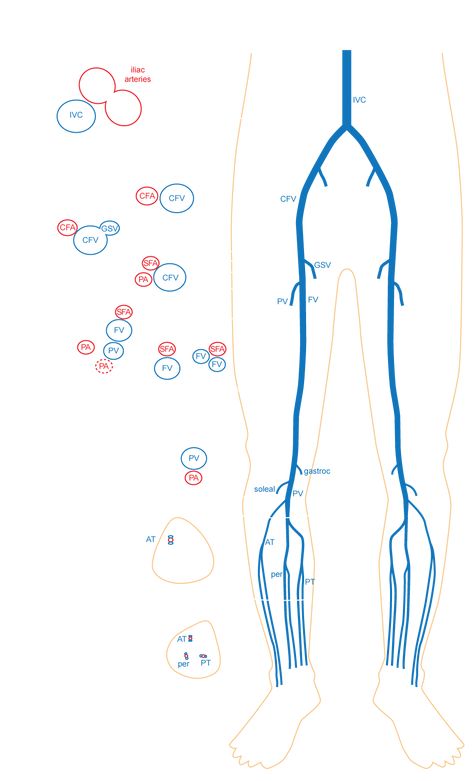 DVT and lower limb ultrasound - EchoPraxis Cath Lab Nursing, Diagnostic Medical Sonography Student, Ultrasound School, Arteries Anatomy, Cardiac Sonography, Vascular Ultrasound, Sonography Student, Ultrasound Sonography, Radiology Student