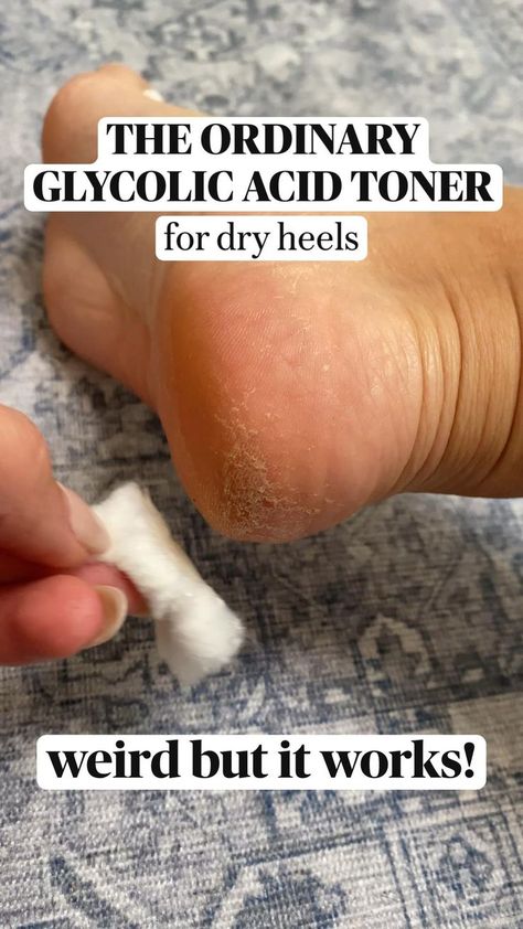 Ordinary Toner, Dry Feet Remedies, Dry Heels, Tongue Health, Baking Soda Shampoo, Cracked Heels, Beauty Remedies, Unwanted Hair Removal, Abdominal Pain