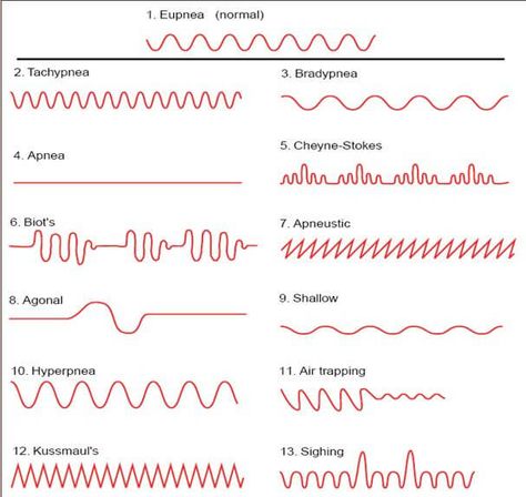 Tingling In Fingers, Breathing Patterns, Metabolic Acidosis, Intracranial Pressure, Respiratory Therapy, Lung Disease, When You Sleep, Chest Pain, Chronic Condition