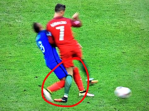 The moment when Dimitri Payet Ended Cristiano Ronaldo's Final.  #Euro2016 Portugal Vs France, Football Injury, Cristiano Ronaldo Portugal, We Are The Champions, Professional Soccer, Soccer News, Match Highlights, Euro 2016, Gareth Bale