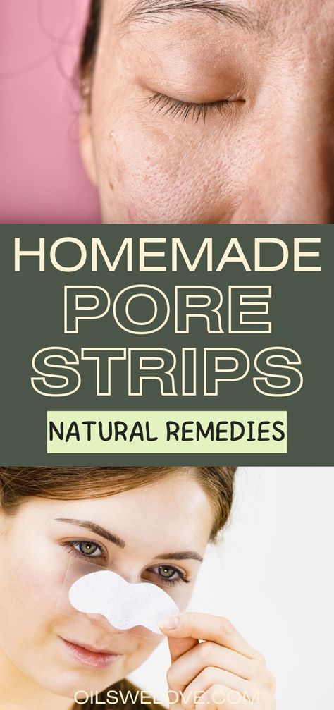 Homemade pore strips to deep clean pores on face Diy Pore Strips, Homemade Pore Strips, Deep Clean Pores, Homemade Beauty Recipes, Pore Strips, Skin Natural Remedies, Facial Brushes, Diy Beauty Recipes, Holistic Remedies