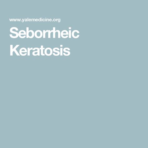 Seborrheic Keratosis Dark Spot Removal, Seborrheic Keratosis, Rough Bumpy Skin, Basal Cell, Strawberry Legs, Care Coordination, Skin Growths, Pregnancy Hormones, Keratosis Pilaris