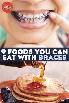 Food To Eat With Braces, Braces Diet, Food With Braces, Band Snacks, Braces Recipes, Soft Foods For Braces, Kid Friendly Meal Prep, Foods To Eat With Braces, Soft Food For Braces