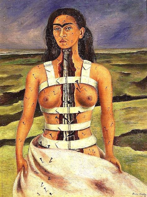 Importance: Kahlo painted this work after surgery to reconstruct her spine that was crushed in a horrible accident. She powerfully used Surrealistic metaphor in representing her body as a toppling column under repair.