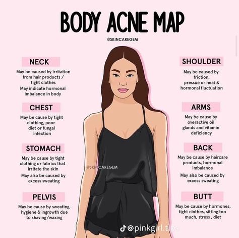 How To Pop Pimples, Body Acne Map, Acne Map, Clear Glass Skin, Selfcare Routine, Skin Advice, Get Rid Of Acne, Rid Of Acne, Body Acne