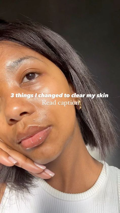 How I clear my skin from acne & treat hyperpigmentation 3 easy steps . 3️⃣ is really the most important step of em all . 1️⃣ I keep my… | Instagram Ginger Shots For Acne, Mind My Business, Simple Cleanser, Lemon Shots, Treat Hyperpigmentation, Ginger Shots, Acne Hyperpigmentation, Treating Hyperpigmentation, Alpha Arbutin