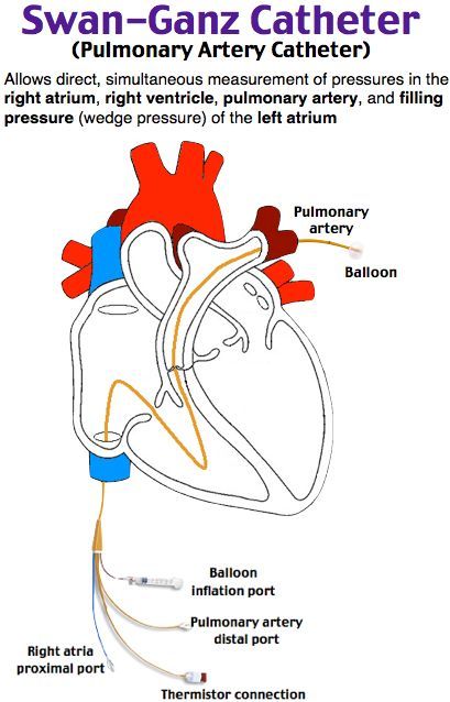 Cvicu Nursing, Cath Lab Nursing, Cath Lab Nurse, Heart Catheterization, Nursing Fun, Nursing Assessment, Nurse Study Notes, Nursing Mnemonics, The Human Heart