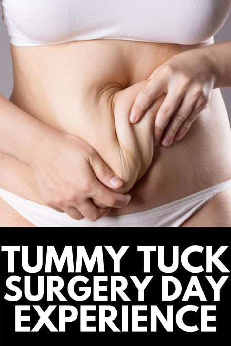 Skin Removal Surgery Before And After, Tummy Tucks Post Op, Plus Size Tummy Tucks Before And After, Mini Tummy Tucks Before And After, Tummy Tucks Recovery Tips, Tummy Tucks Before And After, Bumps On Legs, Sculpting Aesthetic, Body Lift Surgery