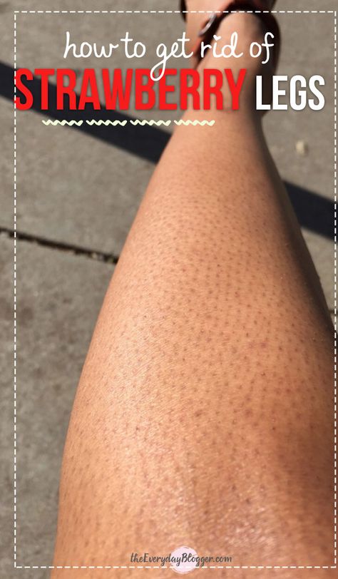 How to Get Rid of Strawberry Legs Yovanna Ventura, Strawberry Legs, Best Makeup Tutorials, Lose 40 Pounds, Unwanted Hair, Face Scrub, Smooth Skin, Beauty Care, Hair Removal