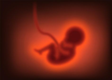 Vector pregnancy concept blurred child i... | Premium Vector #Freepik #vector #embryo #baby-womb #fetus #fetal Baby In Womb, Walk For Life, Pregnancy Facts, About Pregnancy, Clay Art Projects, Blur, Premium Vector, Vector Illustration, Van